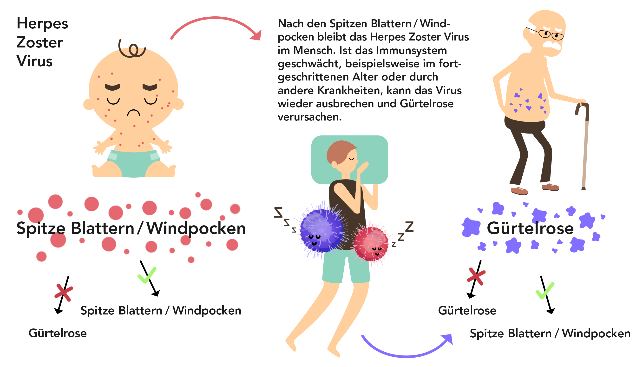 Concordia Gurtelrose Nach Windpocken Concordia